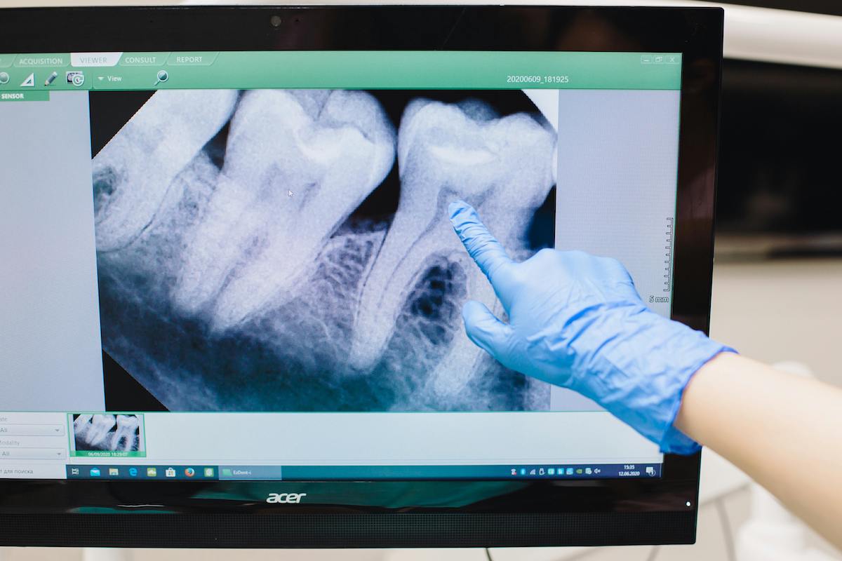 imagen de tratamiento en clínica dental